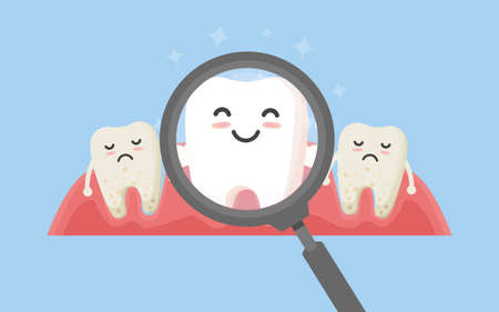 Tooth cleaning. Teeth characters before and after whitening. Cartoon tooth before and after cleaning or whitening or dental procedures. Vector, illustration, eps, flat design, cartoonのイラスト素材