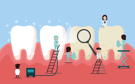 Tooth cleaning. Teeth characters before and after whitening. Cartoon tooth before and after cleaning or whitening or dental procedures. Vector, illustration, eps, flat design, cartoonのイラスト素材