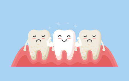 Tooth cleaning. Teeth characters before and after whitening. Cartoon tooth before and after cleaning or whitening or dental procedures. Vector, illustration, eps, flat design, cartoonのイラスト素材