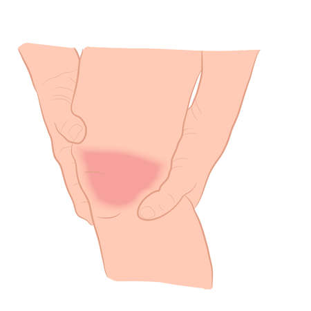 graphics image Tendon bone knee joint problems on leg vector illustrationのイラスト素材