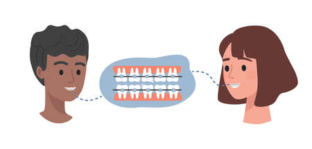 Dental braces on teeth vector flat illustration. Male and female heads and teeth with orthodontic braces.のイラスト素材