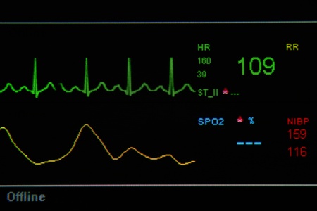 EKG monitor in ICU unit show The waves of blood pressure, blood oxygen saturation, ECG,heart rateの写真素材