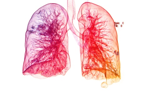 chest X-rays under 3d image ,lungs 3d image show pulmonary diseaseの写真素材