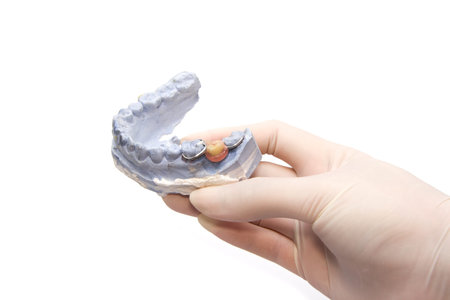Dental prosthesis on gypsum model plaster with doctor hand grapping