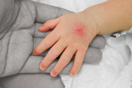 Hand of sick baby with tracks injection   post I  V injection  on her mother hand 