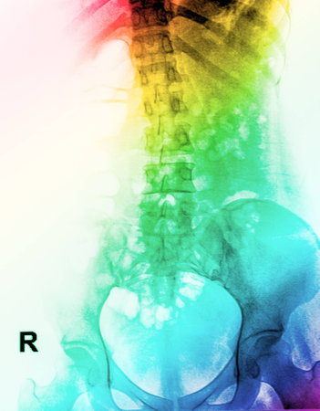 x-ray image of human spinal column for colorful backgroundの写真素材