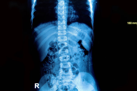 x-ray image spine and pelvis of a human body