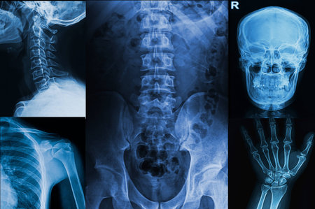 Collection x-rays image of human ,show upper extremity body part of human