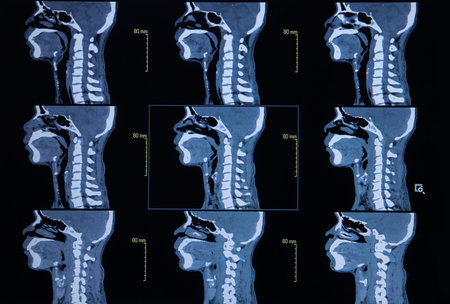 Series of images from a computerized tomography of neck (cervical bone)