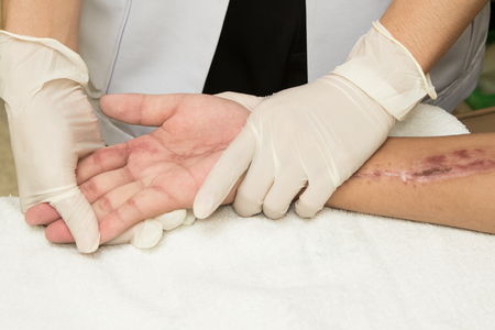 Physical therapist doing hand exercise after injury handの写真素材