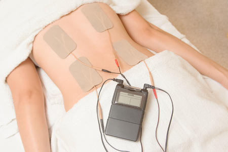 TENs therapy, Electrodes of tens device on back muscleの写真素材