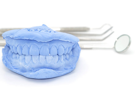 Denture cast gypsum model and dental tools set 