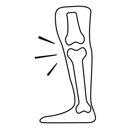 osteoarthritis, knee pain deformity black outline drawingのイラスト素材