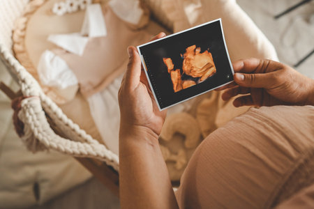 Ultrasound picture pregnant baby photo. Woman holding ultrasound pregnancy image. Concept of...