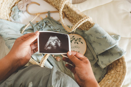 Ultrasound picture pregnant baby photo. Woman holding ultrasound pregnancy image. Concept of...