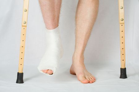 The person with plaster on a foot stands on a floor