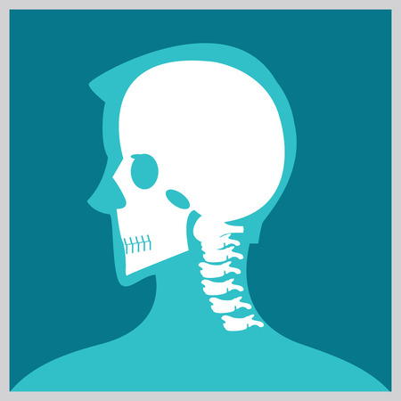 Xray of  head and neck, the joints and bones,human joints, skeletal spinal bone structure of Human Spine, medical health care flat vector illustration.のイラスト素材
