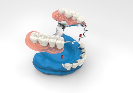 3D rendering dentures