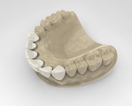 3D rendering denture