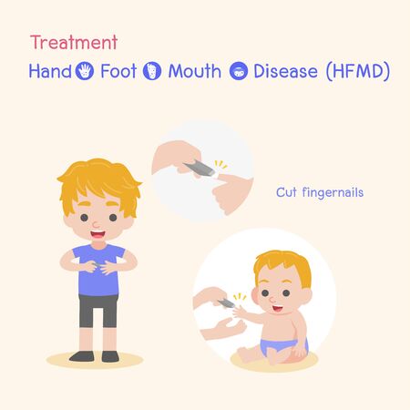 Treatment, Children infected, Baby and child have a Hand Foot Mouth Disease, Medical Health care concept, Cut fingernails, nails, cartoon character vector design.のイラスト素材
