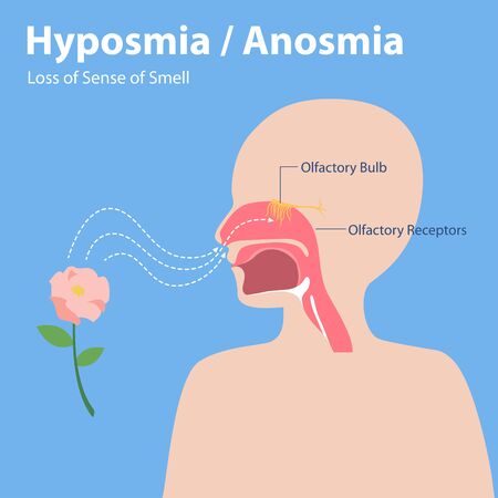 Hyposmia Anosmia, Loss of Sense of Smell Info graphic elements the signs of corona virus Symptoms , Health care concept.のイラスト素材
