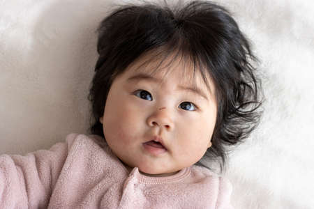 Baby with scratches on the nose (0 years old, 7 months old, girl, Japanese)の写真素材