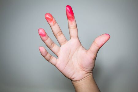 Bloody on the fingers of a zombie in a Halloween festival.の写真素材