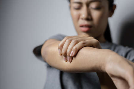 Woman suffering from pain in arm. Concept pain in arm. Young woman with pain in arm.の写真素材