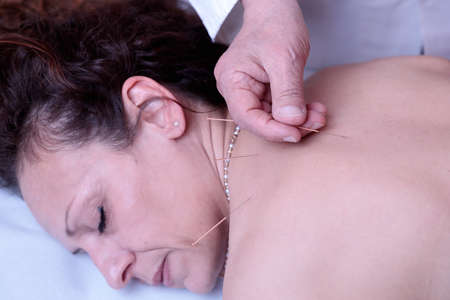 Acupuncturist doctor applies a needle into the skin of the patient lying on the medical bed