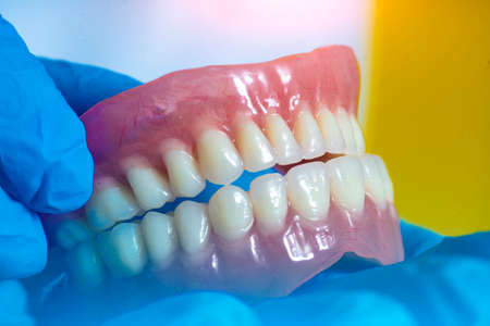 Dental prosthesis in the hands of the doctor close-up. Dentist holding ceramic dental bridge. Front view of complete denture. Dentistry conceptual photo. Prosthetic dentistry.の写真素材