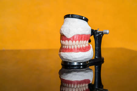 model of teeth for dentists to explain various tooth diseases or problems in yellow background.