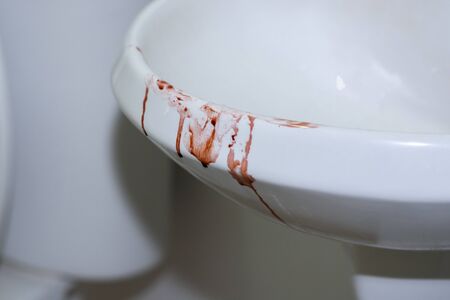 Bloodstain on white basin in bathroomの写真素材