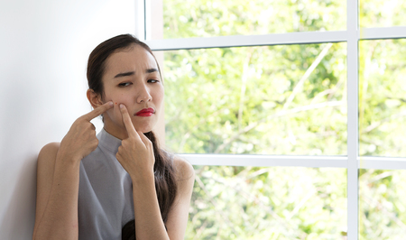 Concept for skin care and face problem. The girl is dismayed with acne on the face. Asian woman unhappy touching her skin.の写真素材