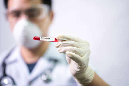 Doctor Hand holding test tube. Asian doctor holding Coronavirus (COVID-19) bloods sample tube and nCoV-19 folder in lab. Selective focus.の写真素材