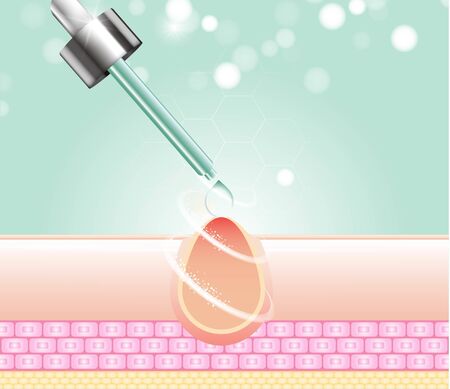 Three main layer of the human skin. skin aging stages diagrams, ollagen and elastin progressive decrease close up, skincare infographics. Illustration about medical diagram.のイラスト素材