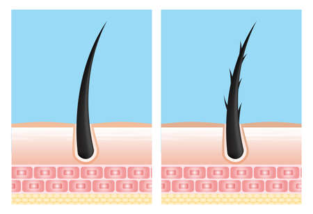 Hair care serum follicle diagnostics. Anatomy skin, medical human, epidermis layer, vector illustration design.のイラスト素材