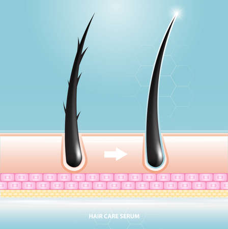 Hair care serum follicle diagnostics. Anatomy skin, medical human, epidermis layer, vector illustration design.のイラスト素材