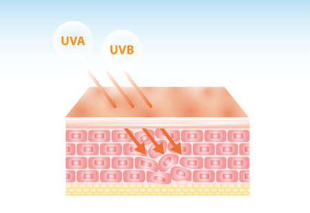 UV reflection skin after protection vector design.のイラスト素材