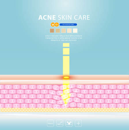 acne skin spot pimple problem vector design.のイラスト素材