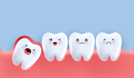 Wisdom teeth under the gums cause pain in the mouth. Impacted wisdom tooth character pushing adjacent teeth causing inflammation, toothache, gum pain. vector design.のイラスト素材