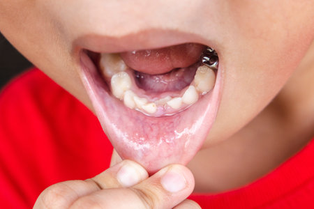 Child milk teeth fall out from gum. little boy permanent tooth grows in mouth. Cute kid open her mouth show teeth and gums. Concept of health, dentist, hygiene, medical, Healthy teeth, dental clinic.の写真素材