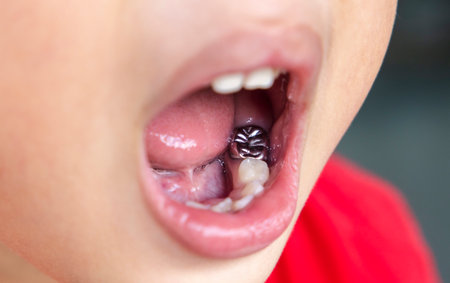 Child milk teeth fall out from gum. little boy permanent tooth grows in mouth. Cute kid open her mouth show Dental Crown and gums. Concept of health, dentist, hygiene, medical, Healthy teeth, clinic.の写真素材