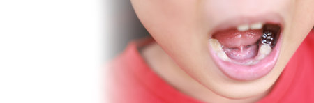 Child milk teeth fall out from gum. little boy permanent tooth grows in mouth. Cute kid open her mouth show Dental Crown and gums. Concept of health, dentist, hygiene, medical, Healthy teeth, clinic.の写真素材