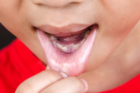 Child milk teeth fall out from gum. little boy permanent tooth grows in mouth. Cute kid open her mouth show teeth and gums. Concept of health, dentist, hygiene, medical, Healthy teeth, dental clinic.の写真素材