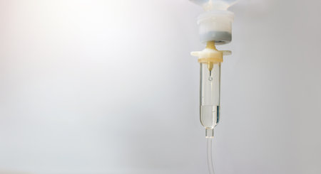 Saline drip in the hospital. 0.9% Normal saline solution NSS. Set vitamin iv fluid intravenous drop Because it is influenza A. Concept about of treatment, emergency, medical, chemotherapy, sick.の写真素材