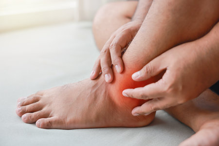 A man injured his ankle and it was swollen and red. Causes of pain include Ankle sprain, Gout, Rheumatoid arthritis, office syndrome, numbness, and cramp symptoms. Healthcare medical concept.の写真素材