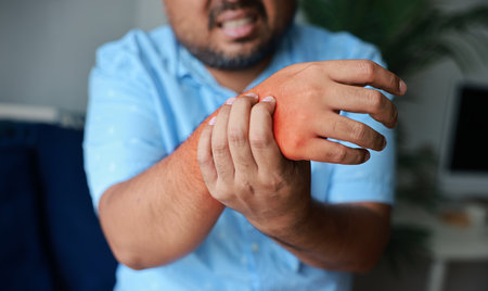 Young man injured his wrist and it was swollen and red. Causes of pain include heavy use, Gout,...