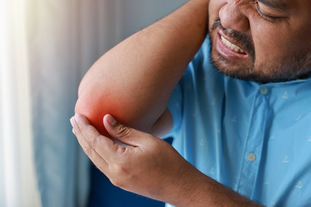 A man injured his elbow and it was swollen and red. Causes of pain include Lifting heavy objects, Gout, Rheumatoid arthritis, office syndrome, numbness, and cramp symptoms. Healthcare medical concept.の写真素材