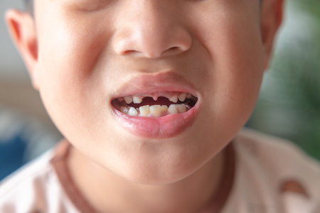 Close-up of a young Asian boy with missing front teeth smiling in natural light, showing the stage of childhood tooth loss and growth in a candid and expressive moment.の写真素材