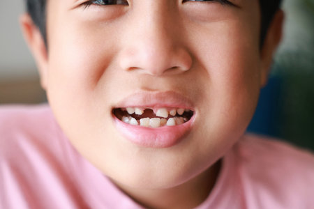 Close-up of a young Asian boy with missing front teeth smiling in natural light, showing the stage of childhood tooth loss and growth in a candid and expressive moment.の写真素材